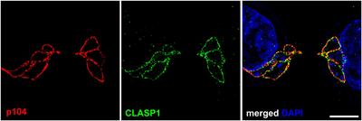 Theileria’s Strategies and Effector Mechanisms for Host Cell Transformation: From Invasion to Immortalization